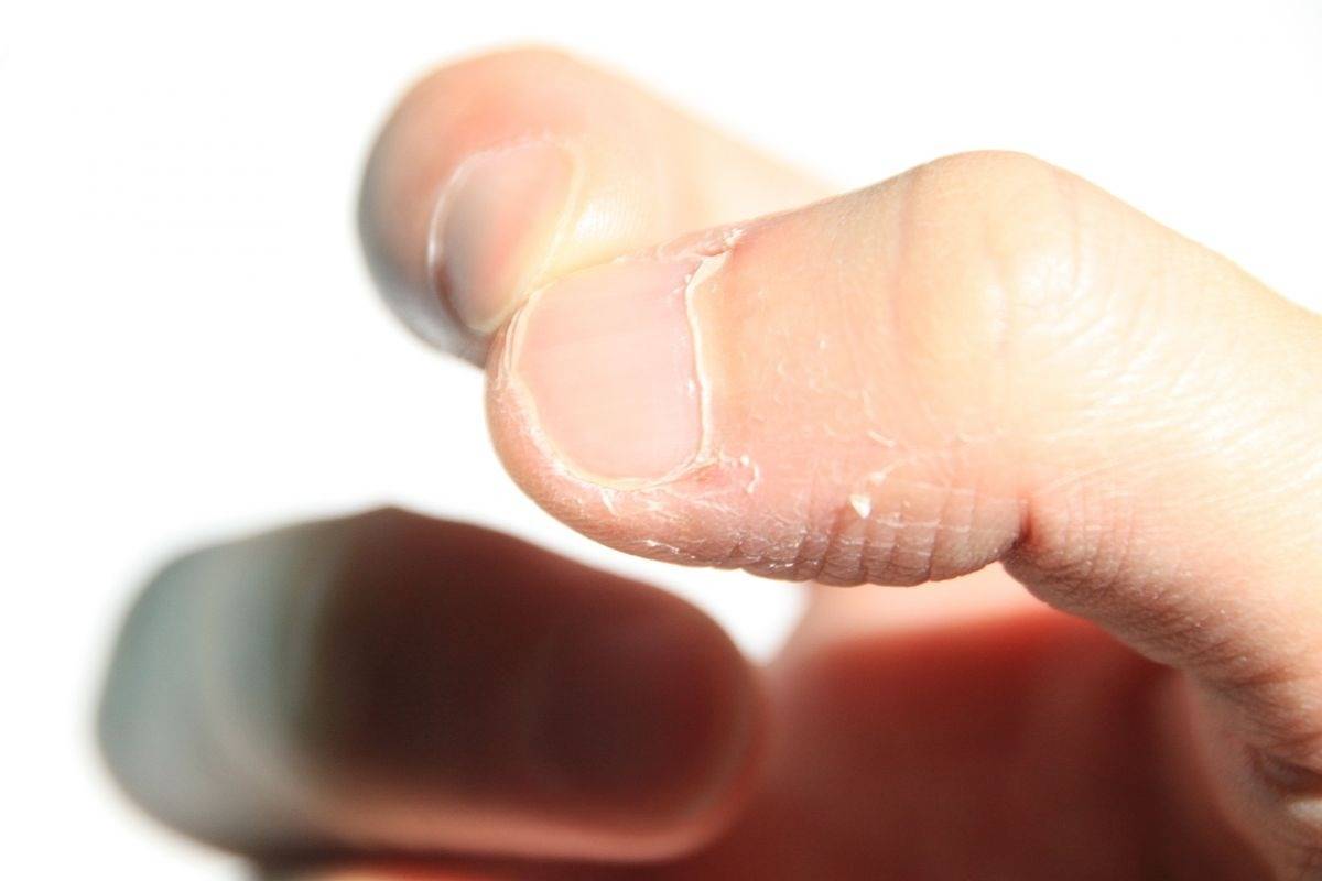 ネイルサロンでささくれを防ぐ方法とケアのポイント