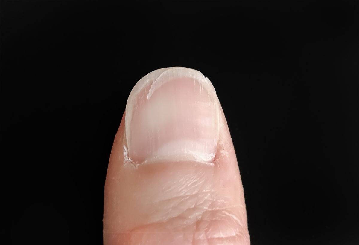 ネイルサロンで割れた爪補修法とジェルケアの全知識完全ガイド